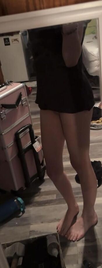 Ally_solez