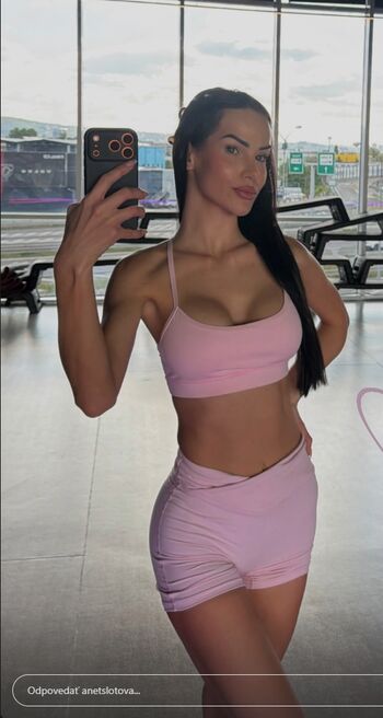 Anet Slotova Leaked Nude OnlyFans (Photo 1)