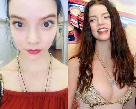 Anya Taylor Joy