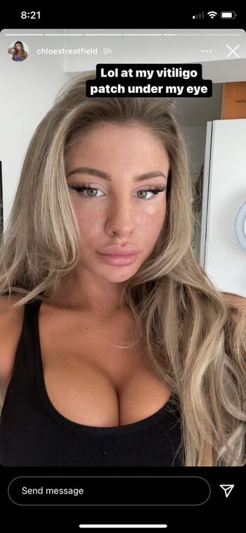 Chloe Streatfield