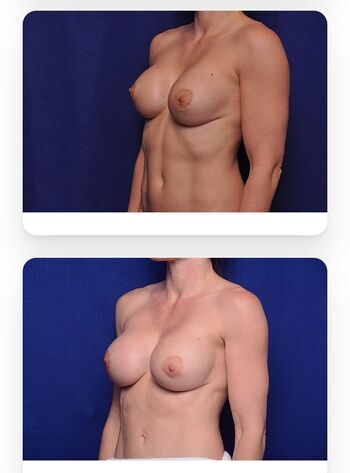 Cory Chase Leaked Nude OnlyFans (Photo 817)