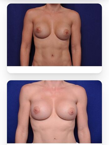 Cory Chase Leaked Nude OnlyFans (Photo 818)