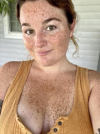 Freckled Baby