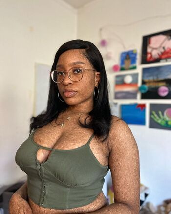 freckledn Leaked Nude OnlyFans (Photo 26)