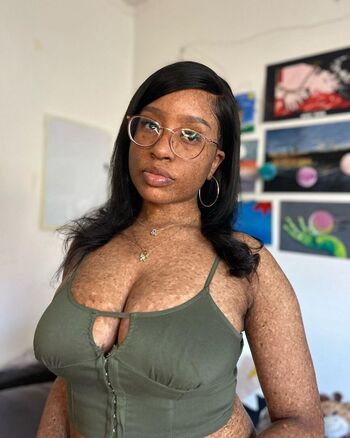 freckledn
