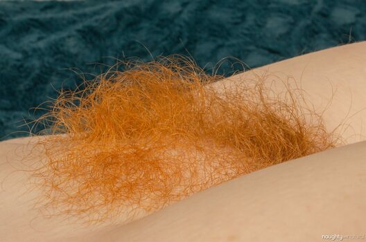 Hairy Women