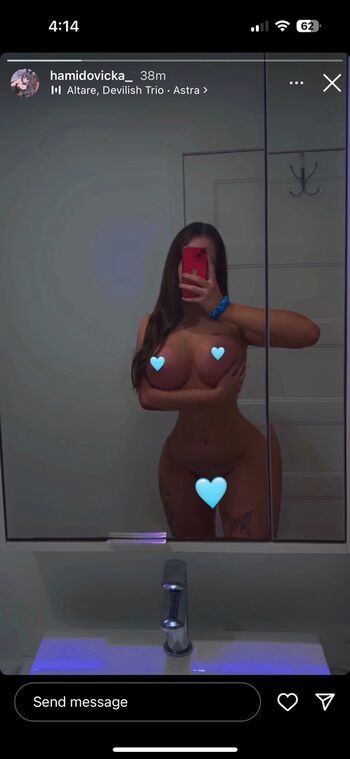 Mirzaxox Leaked Nude OnlyFans (Photo 15)