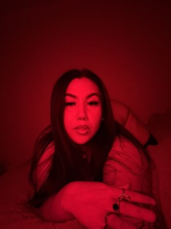 missnalgonadtx