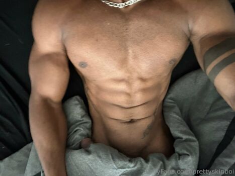 prettyskinboi