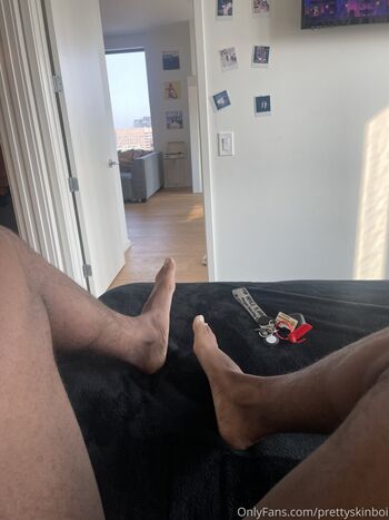 prettyskinboi