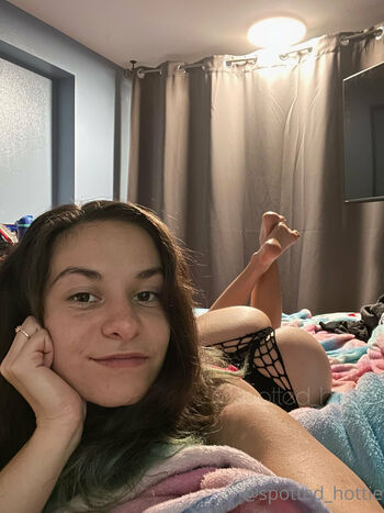 spottedhottie21