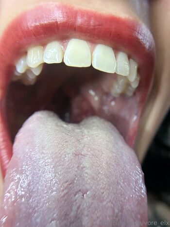 vore_elx