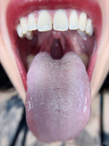 vore_elx