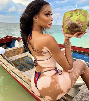 Winnie Harlow