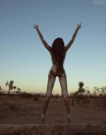 Winnie Harlow